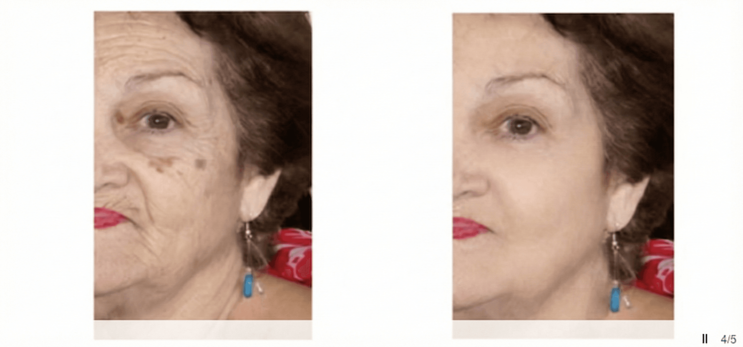 Cosmetic digital surgery example 1